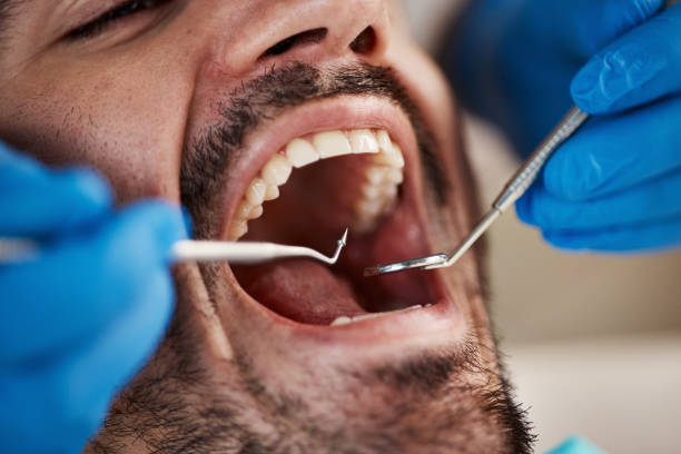 Best Tooth Infection Emergency Dentist  in Roman Forest, TX